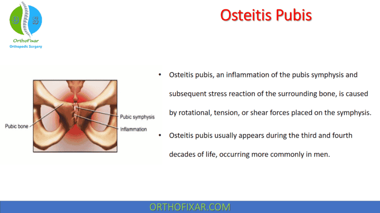 Osteitis Pubis