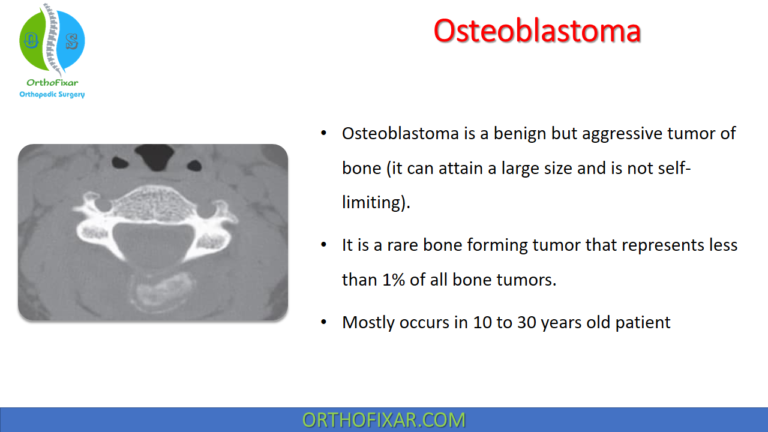 Osteoblastoma