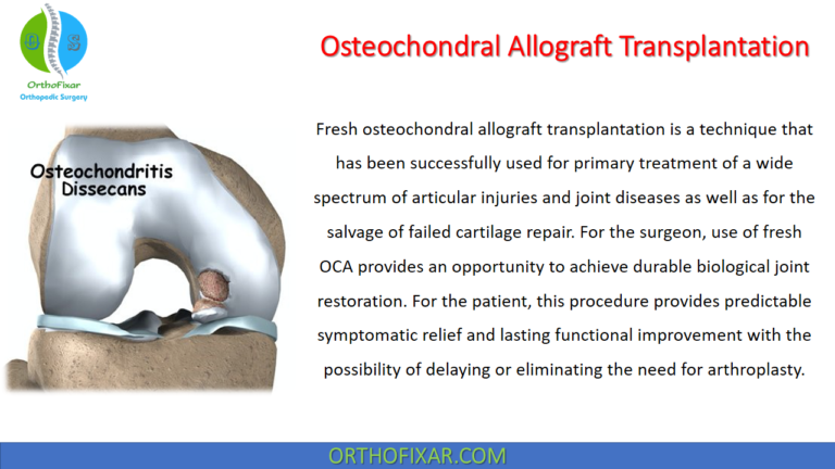 Osteochondral Allograft Transplantation