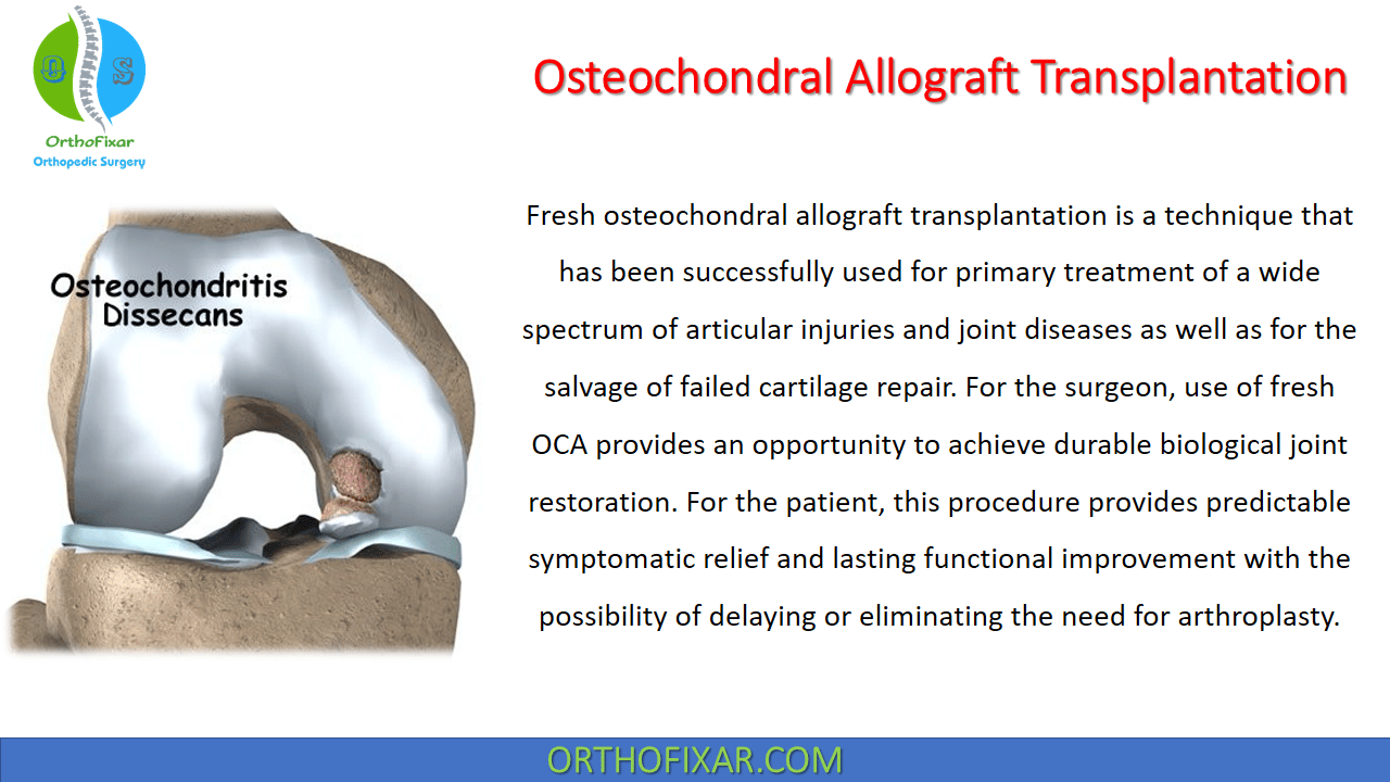  Osteochondral Allograft Transplantation 