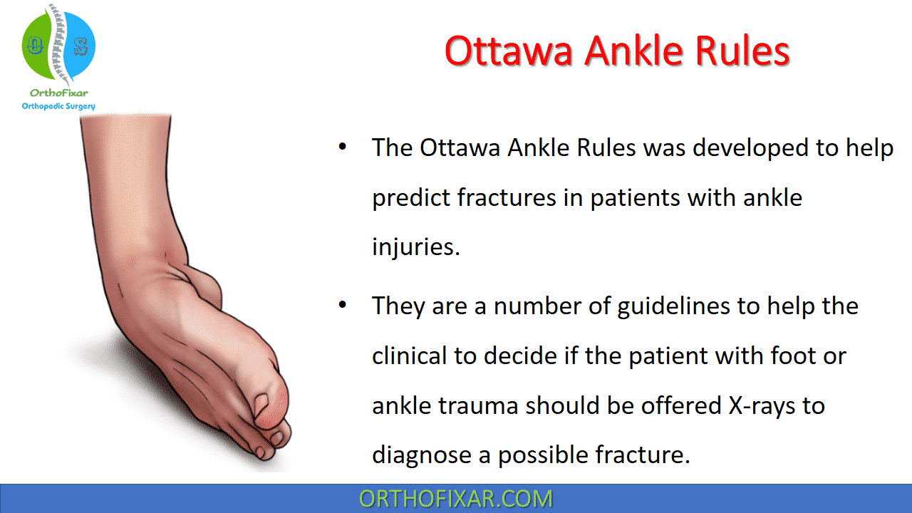 Ottawa Ankle Rules | OrthoFixar 2025