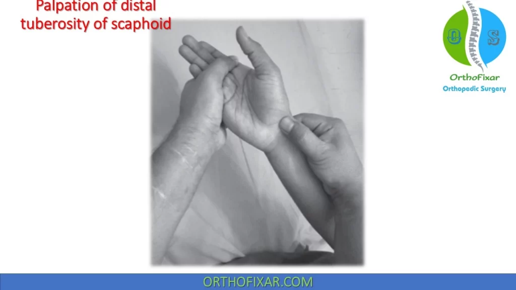 Palpation of distal tuberosity of scaphoid