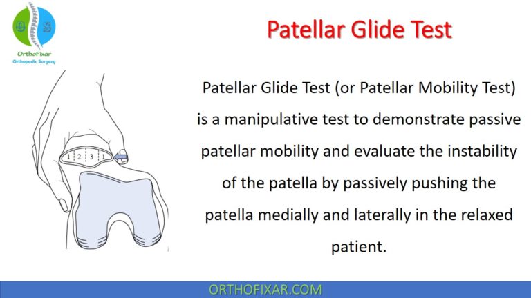 Patellar Glide Test