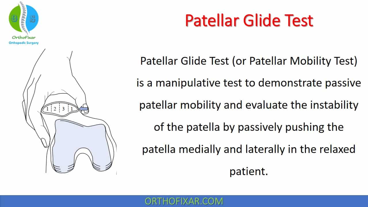  Patellar Glide Test 