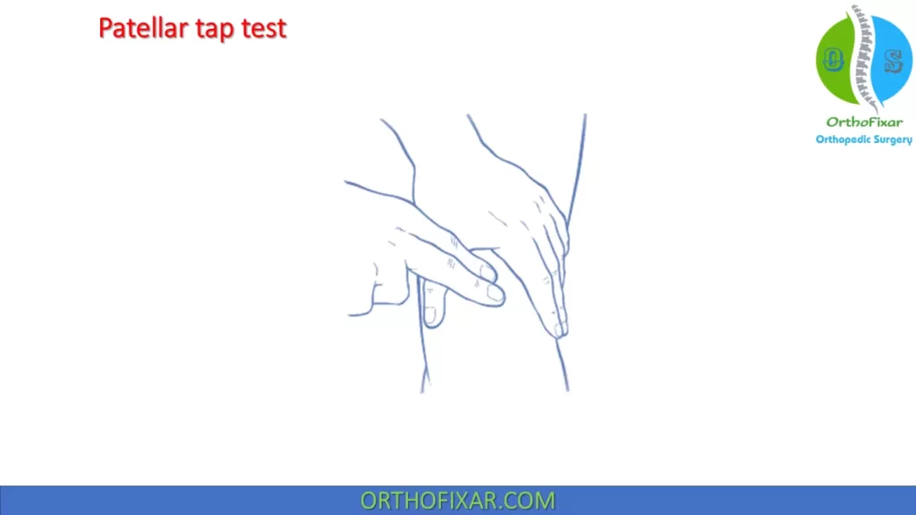 Patellar tap test