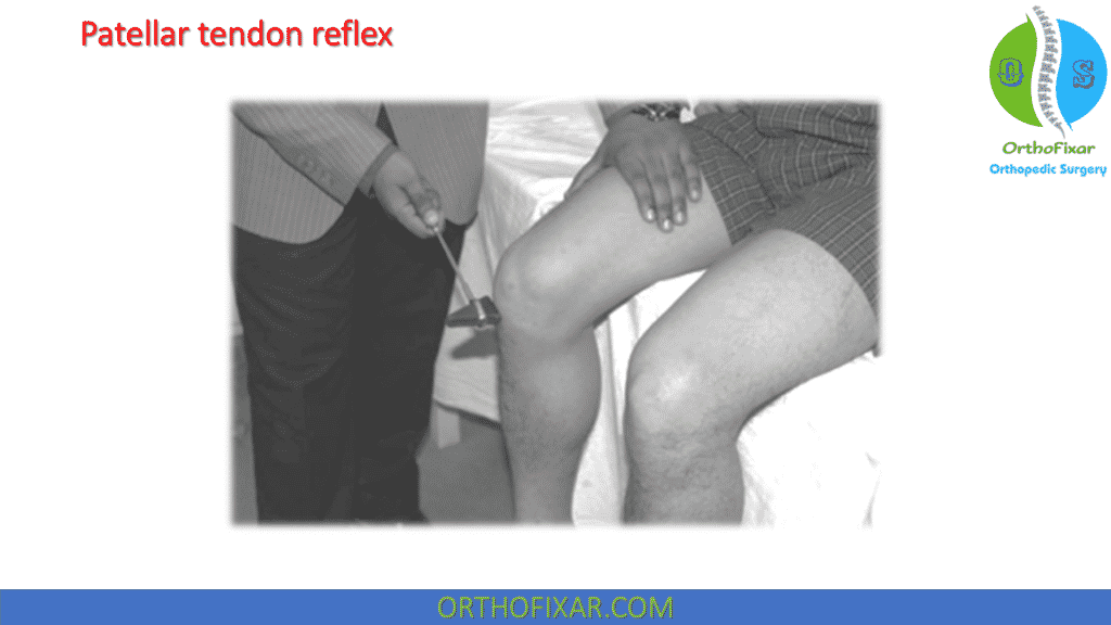 Patellar tendon reflex- L4 nerve root