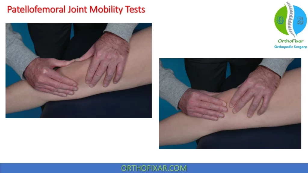 Patellofemoral Joint Mobility Tests