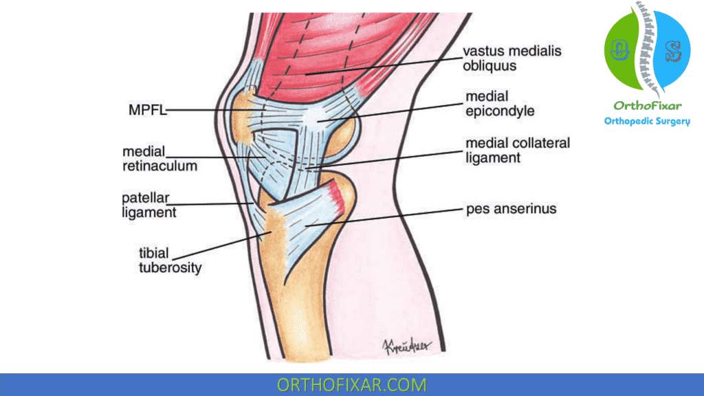 Patellofemoral Joint medial ligaments