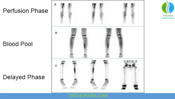 Bone Scan Radionuclide Imaging: Principles, Applications & Interpretation 7 Phases of Bone Scan Imaging