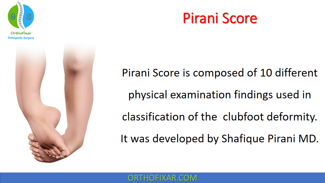 Pirani Score – Clubfoot Deformity