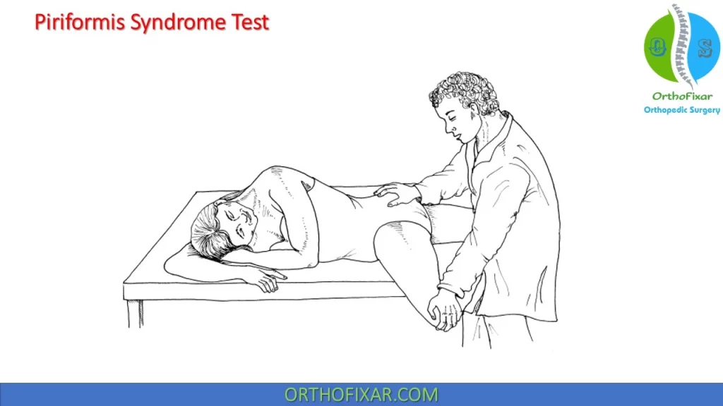 Piriformis Syndrome Test 2
