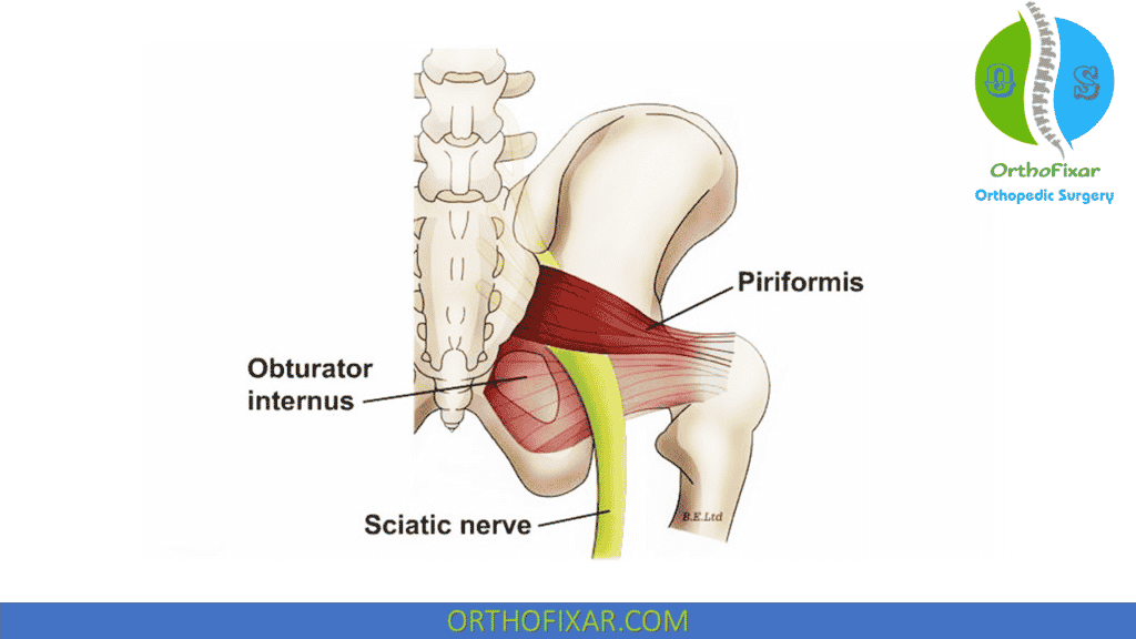 Piriformis Syndrome anatomy