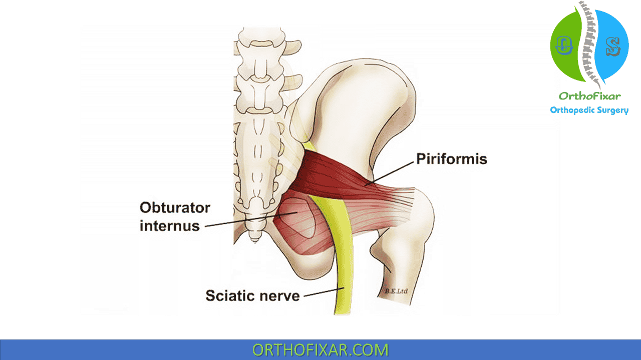 https://orthofixar.com/wp-content/uploads/Piriformis-Syndrome-anatomy.png