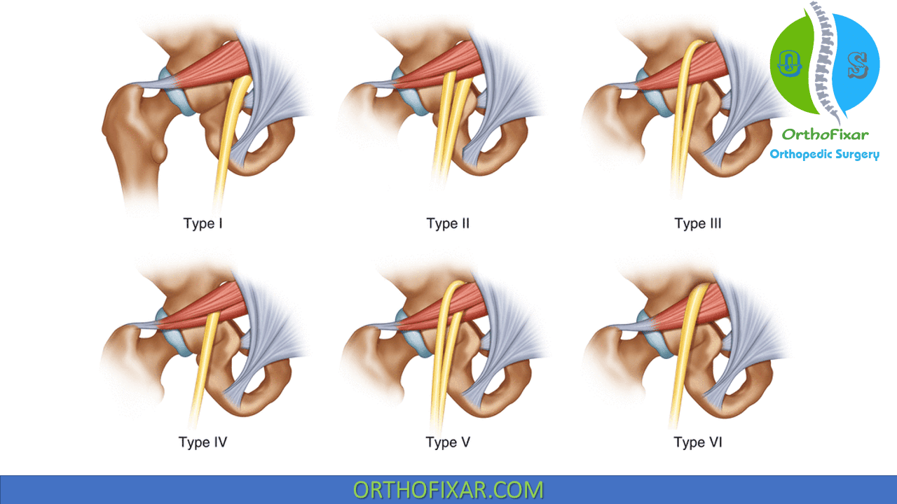 Piriformis Muscle Anatomy