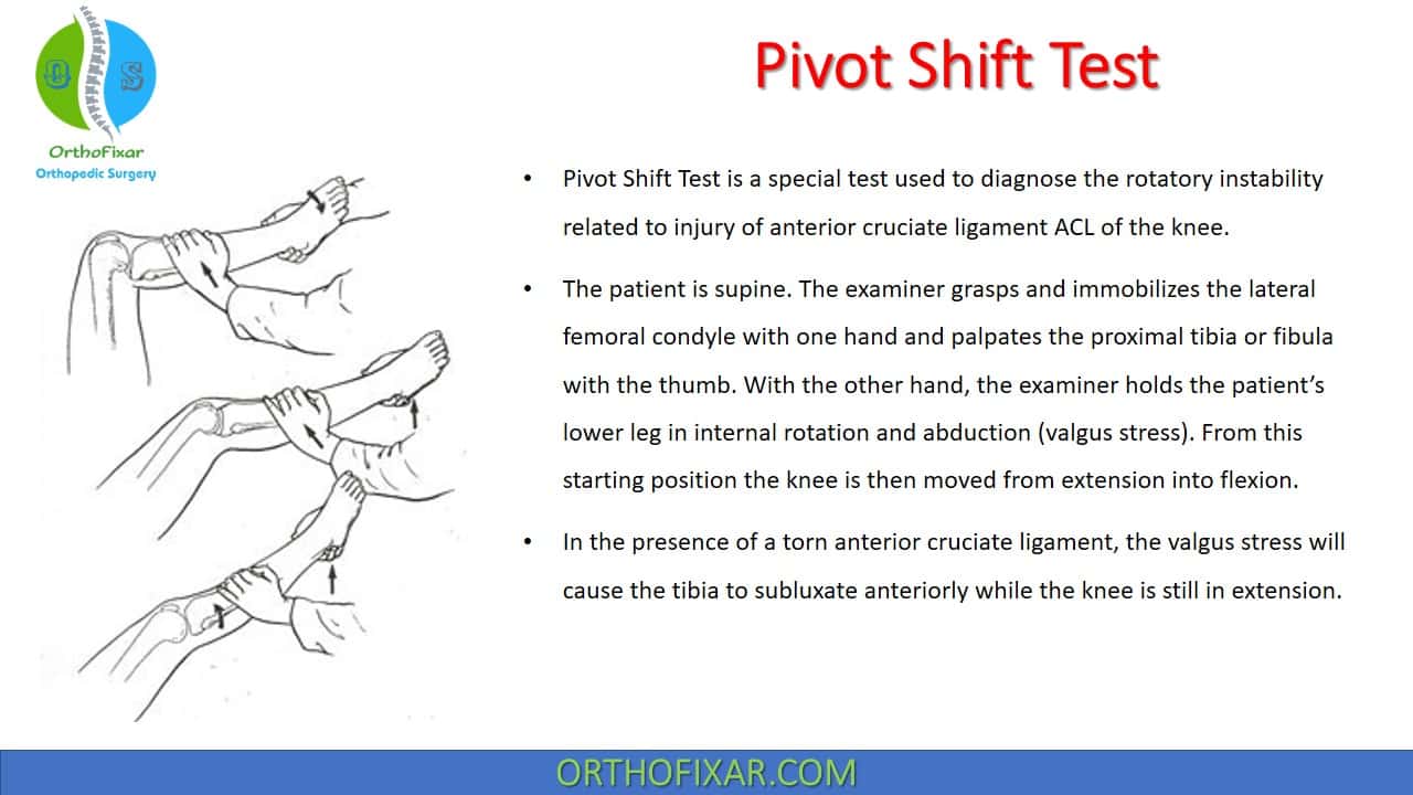 pivot shift test youtube