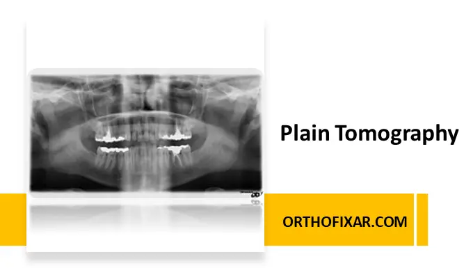 Plain Tomography