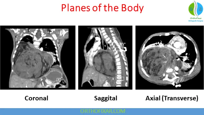 Planes of the Body