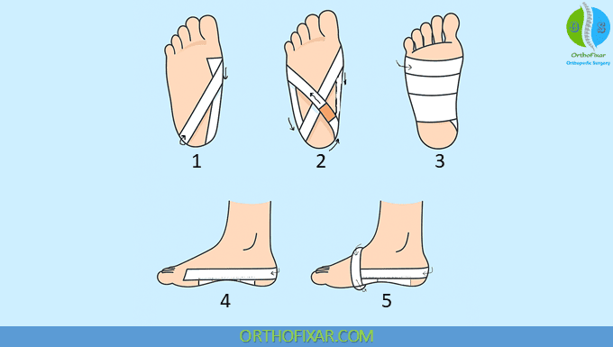 Plantar Fascia Support Taping Technique