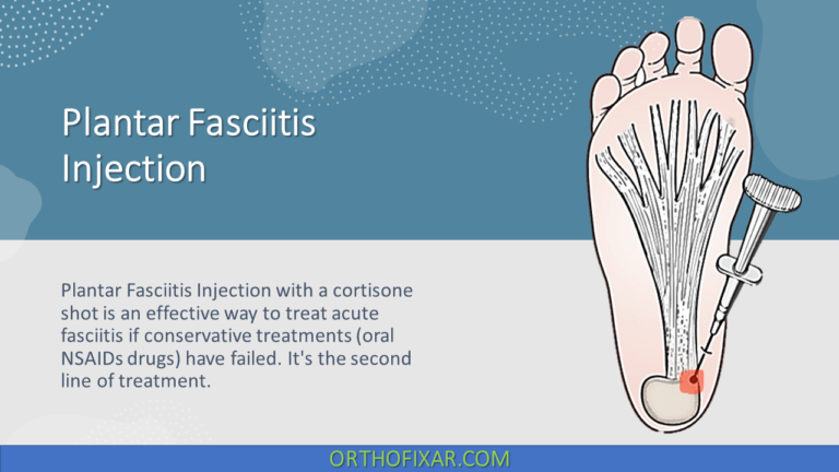 Plantar Fasciitis Injection