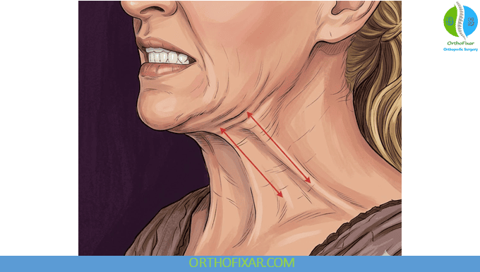 Platysma Muscle Anatomy 5 Platysma