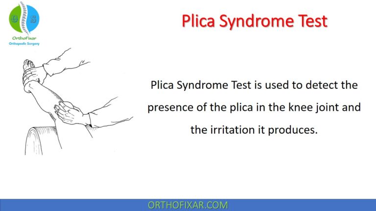 Plica Syndrome Test