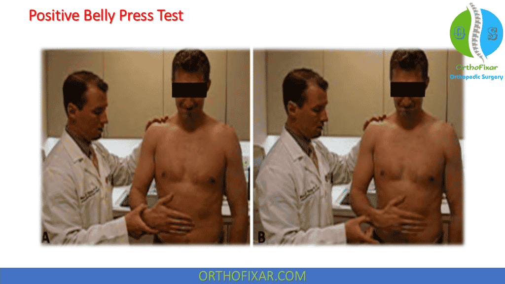 Positive Belly Press Test 