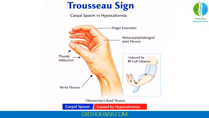 Positive Trousseau Sign