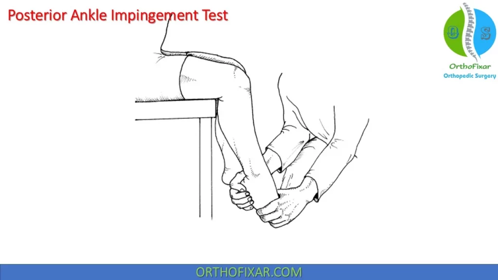 Posterior Ankle Impingement Test