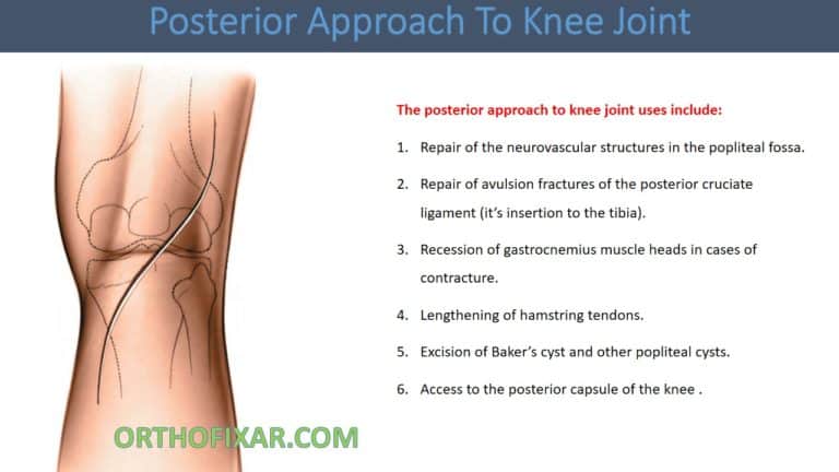 Posterior Approach To Knee Joint