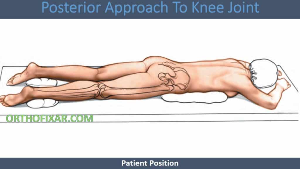 Posterior Approach To Knee Joint