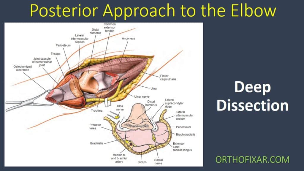Posterior Approach to the Elbow