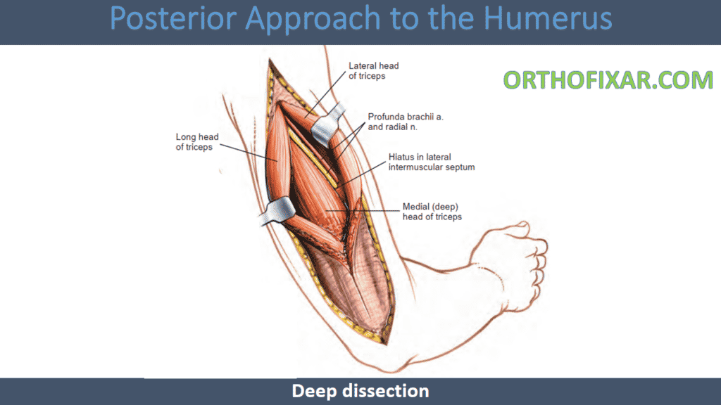 Posterior Approach to the Humerus deep (1)