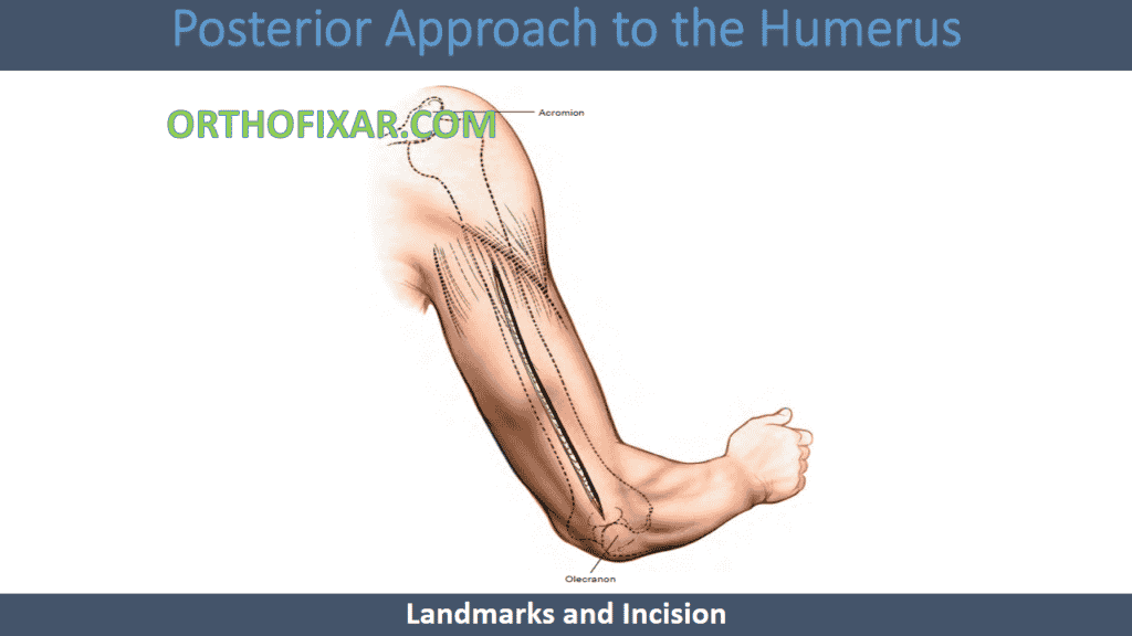 Posterior Approach to the Humerus incision