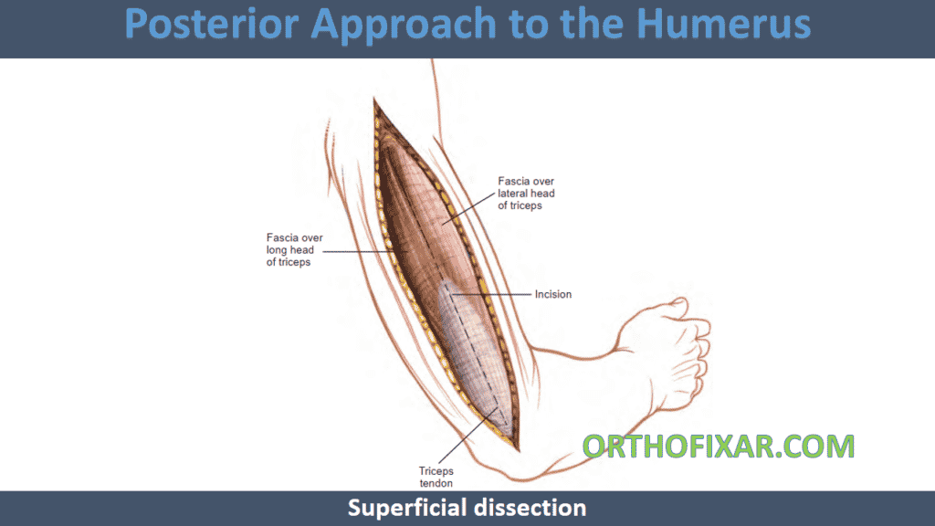 Posterior Approach to the Humerus superficial