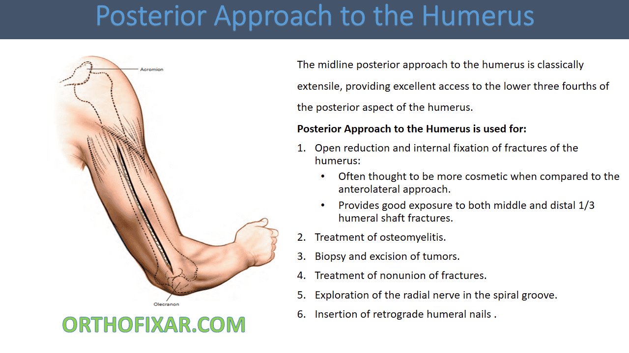 Posterior Approach to the Humerus