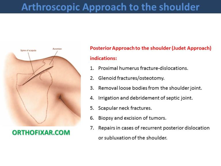 Posterior Approach to the shoulder