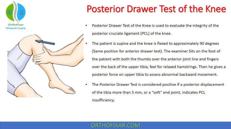 Posterior Drawer Test