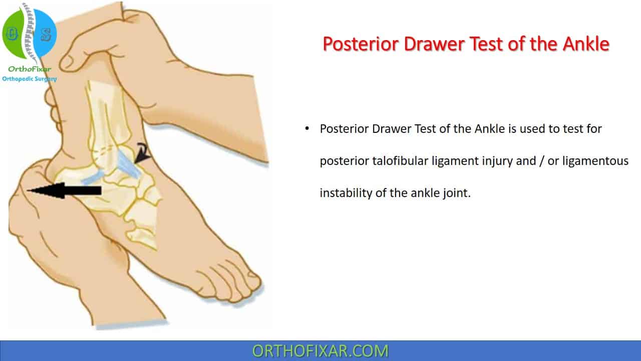  Posterior Drawer Test (Ankle) 