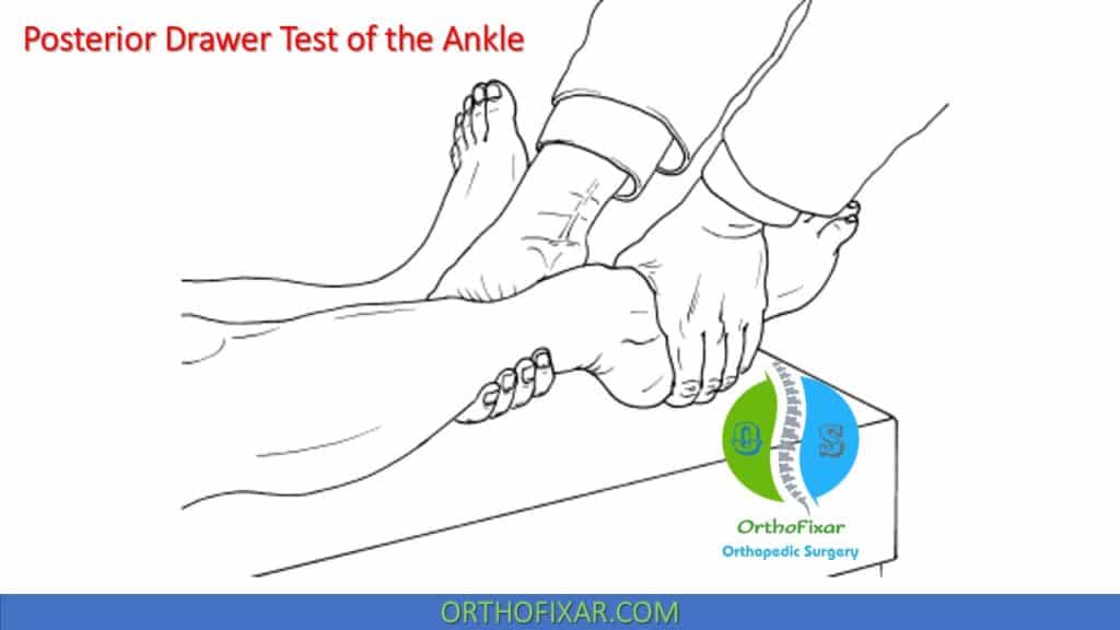 Posterior Drawer Test of the Ankle