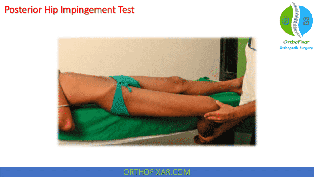 Posterior Hip Impingement Test