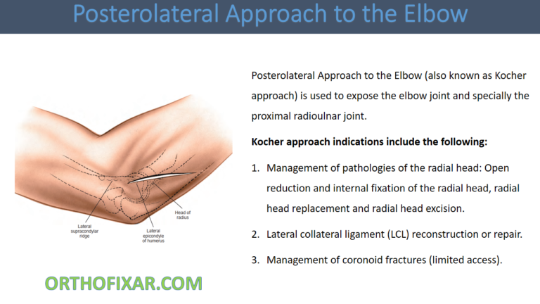 Posterolateral Approach to the Elbow