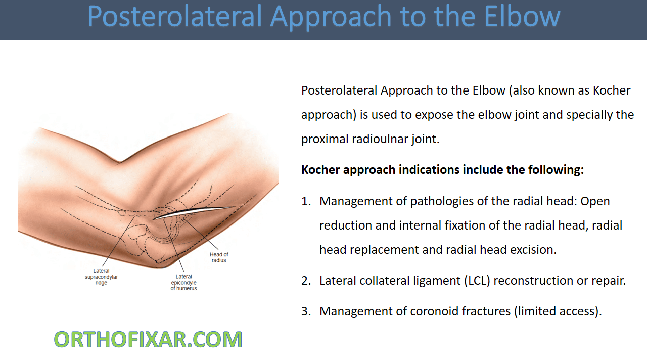  Posterolateral Approach to the Elbow 