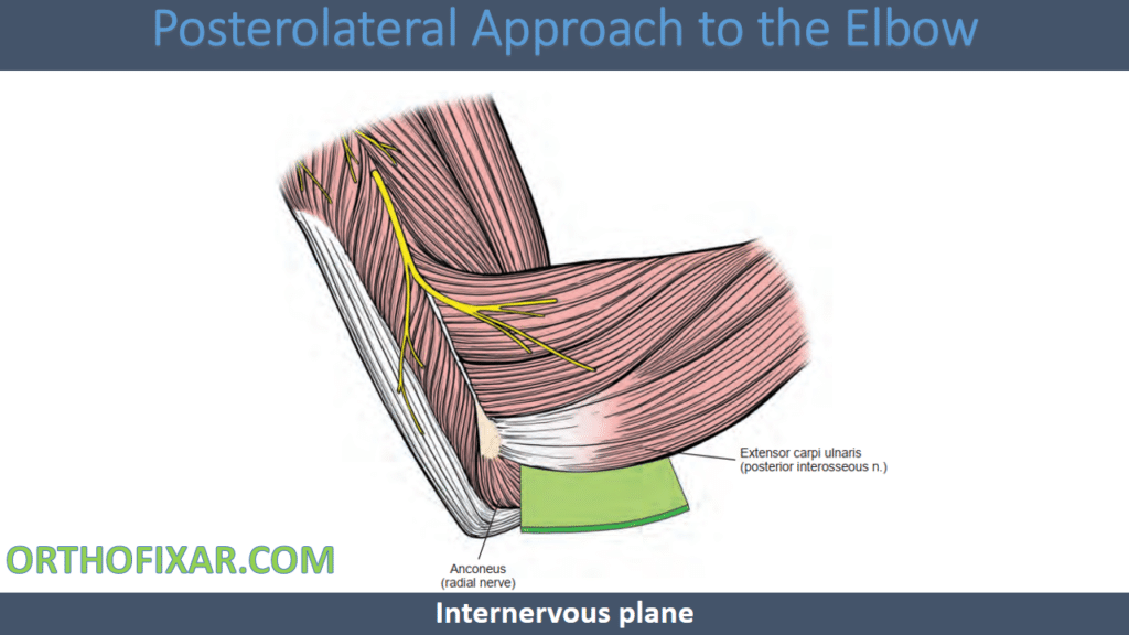 Posterolateral Approach to the Elbow