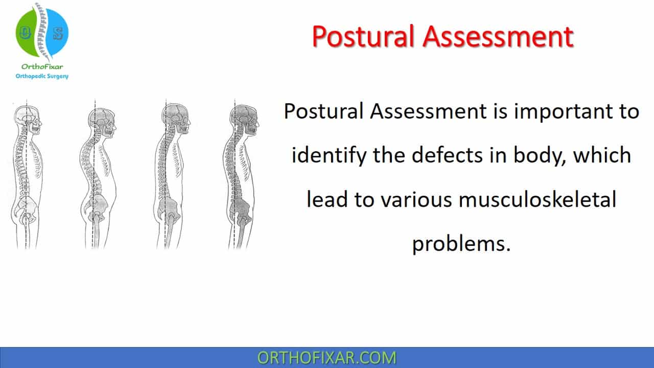 Postural Assessment OrthoFixar 2023, 52% OFF