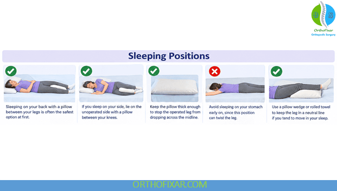 Preventing Hip Dislocation After Replacement Surgery 3