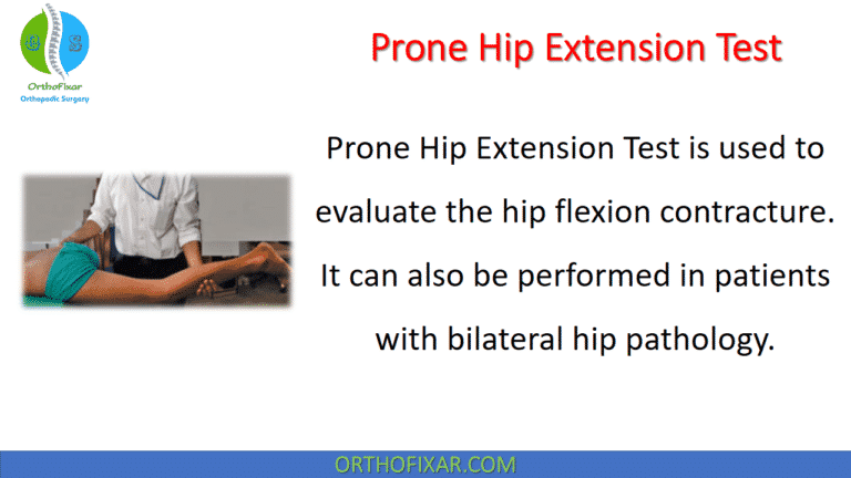 Prone Hip Extension Test