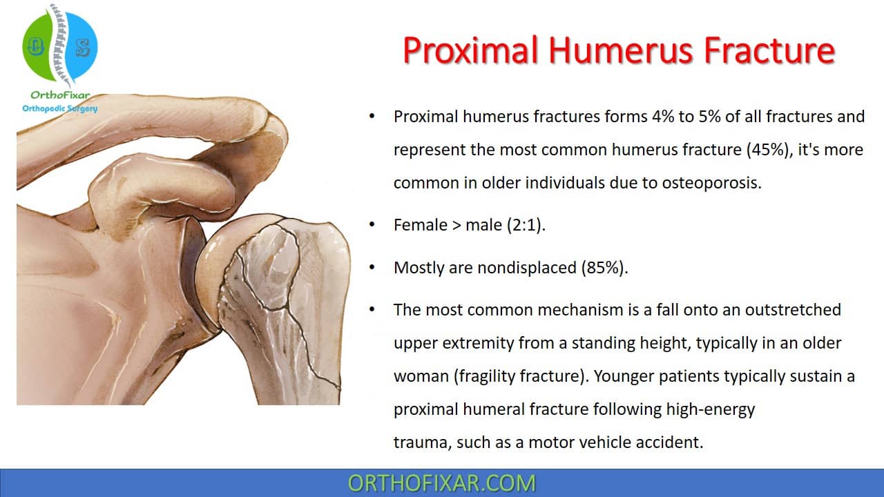 What is the best position for a fractured humerus?