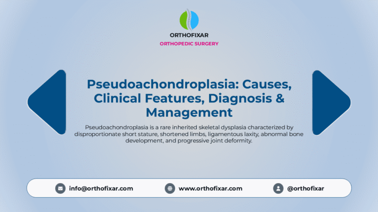 Pseudoachondroplasia