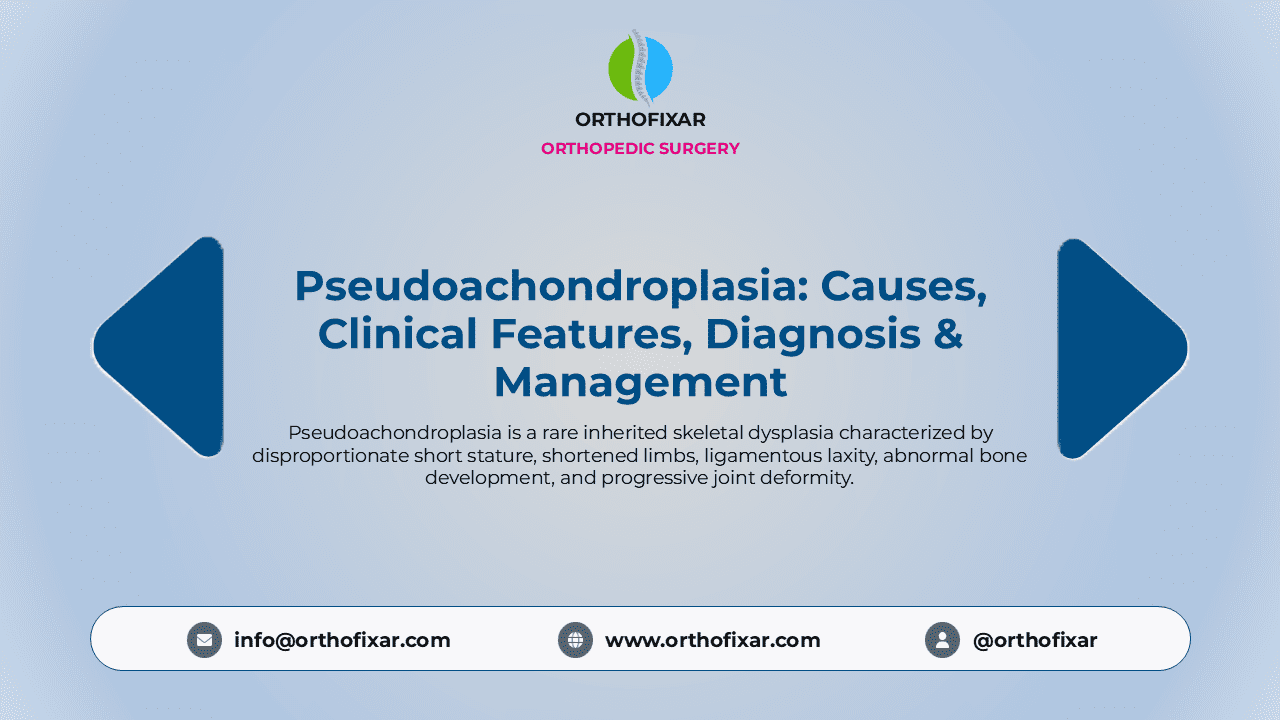 Pseudoachondroplasia
