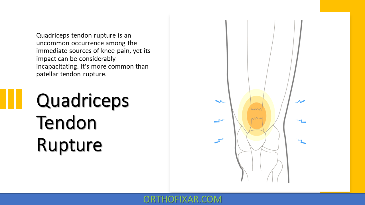  Quadriceps Tendon Rupture 